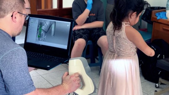 How 3D printing is making prosthetics cheap and accessible, even in remote places