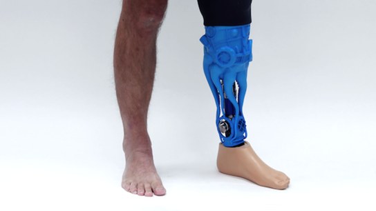3D scanning helps create one-of-a-kind prosthesis