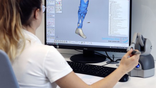 Verbesserte Lebensqualität dank 3D-Scanning: Erstellung einer maßgeschneiderten Prothese mithilfe modernster 3D-Scantechnologie von Artec 3D