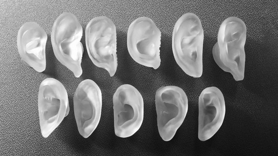 How Dr. Sheryl Lewin uses Artec Space Spider to create beautiful new ears for microtia patients
