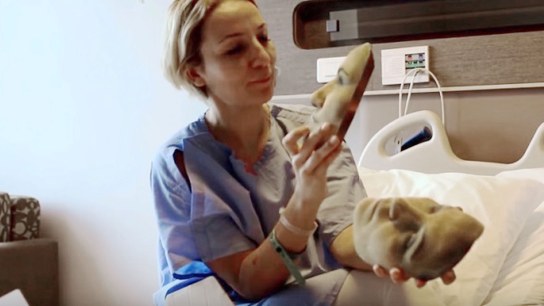 Plastic surgeon uses Artec Eva to show patients their future faces