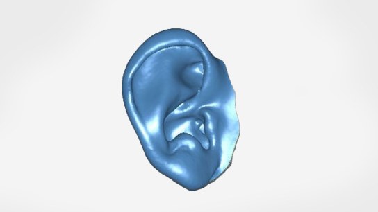 Using 3D scanning and printing to help children with ear deformities